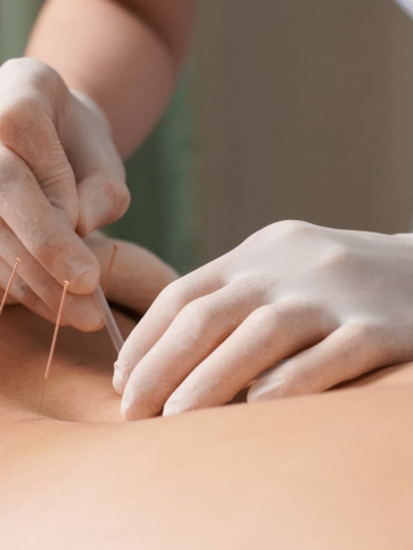 Acupuncture During Chemo: A Safe Alternative?